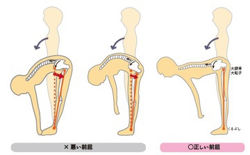 股関節 硬い 原因